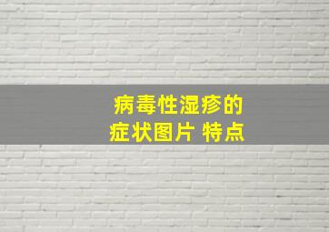 病毒性湿疹的症状图片 特点